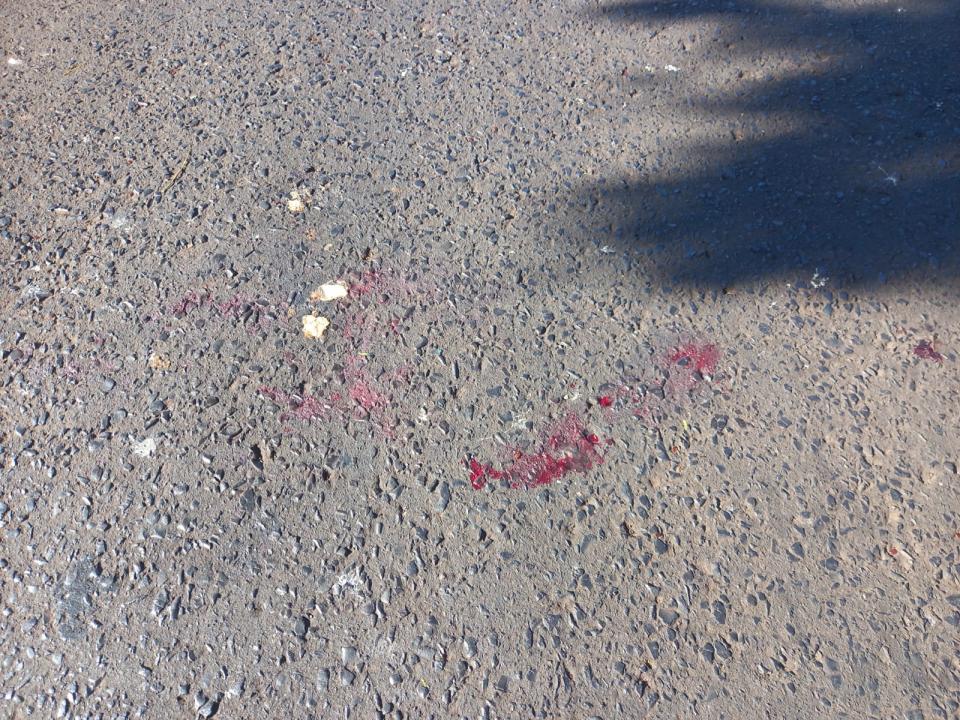 Foto 9 de 9 — Menino de 6 anos é atropelado por moto na Vaz Filho